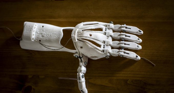 ¿Las extremidades artificiales impresas en 3D son la solución en implantes?